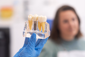Odontología de Implantes