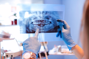 Dental professional wearing gloves holding and examining a dental X-ray film.