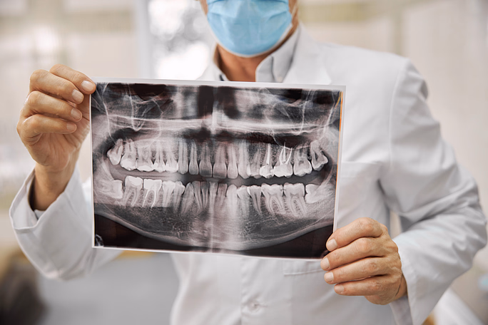 Dentista con mascarilla sosteniendo una radiografía dental que muestra la dentadura superior e inferior completa y la estructura de la mandíbula.