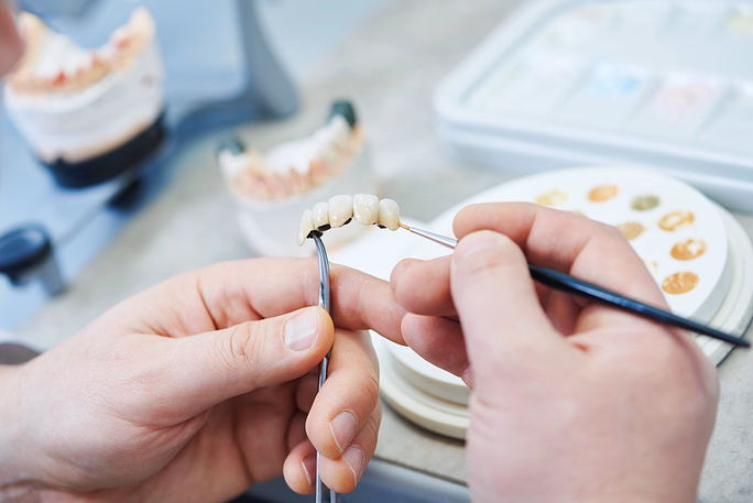 Manos sosteniendo y pintando una prótesis dental con un pincel pequeño en un laboratorio dental.
