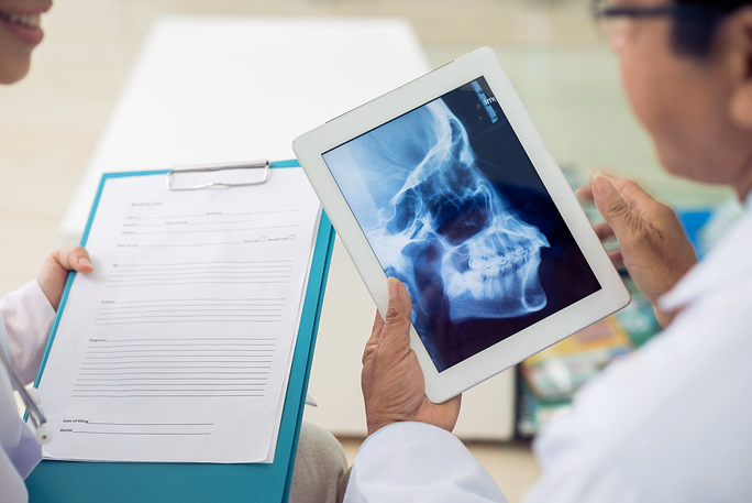Doctor sosteniendo una tableta que muestra una radiografía de un cráneo mientras consulta con un paciente que sostiene un portapapeles médico.