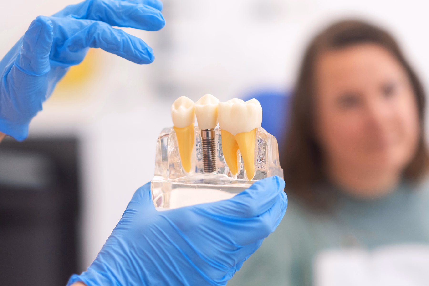 Implant Restorations