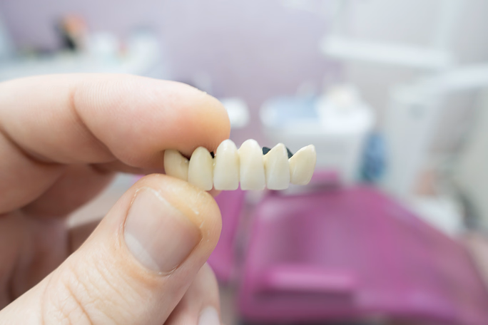Primer plano de una mano sosteniendo una prótesis dental con varios dientes artificiales conectados.